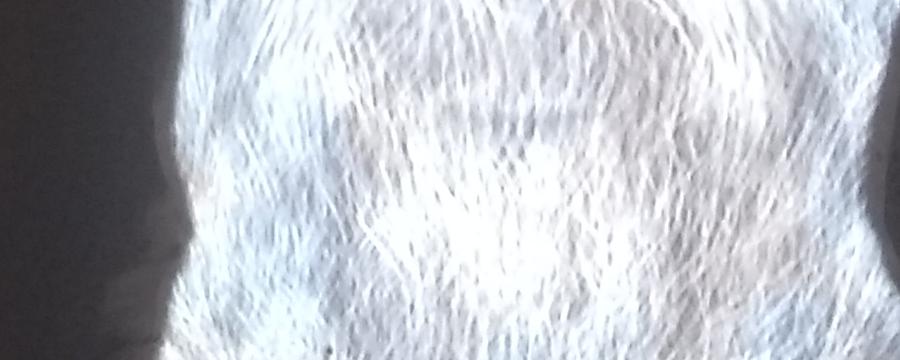 Installation